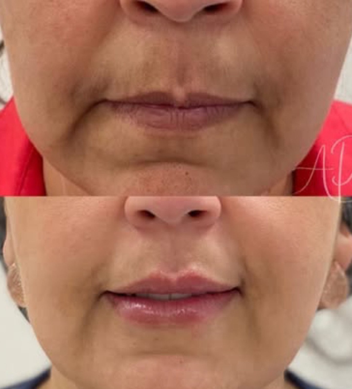 Antes e depois de tratamento de boca