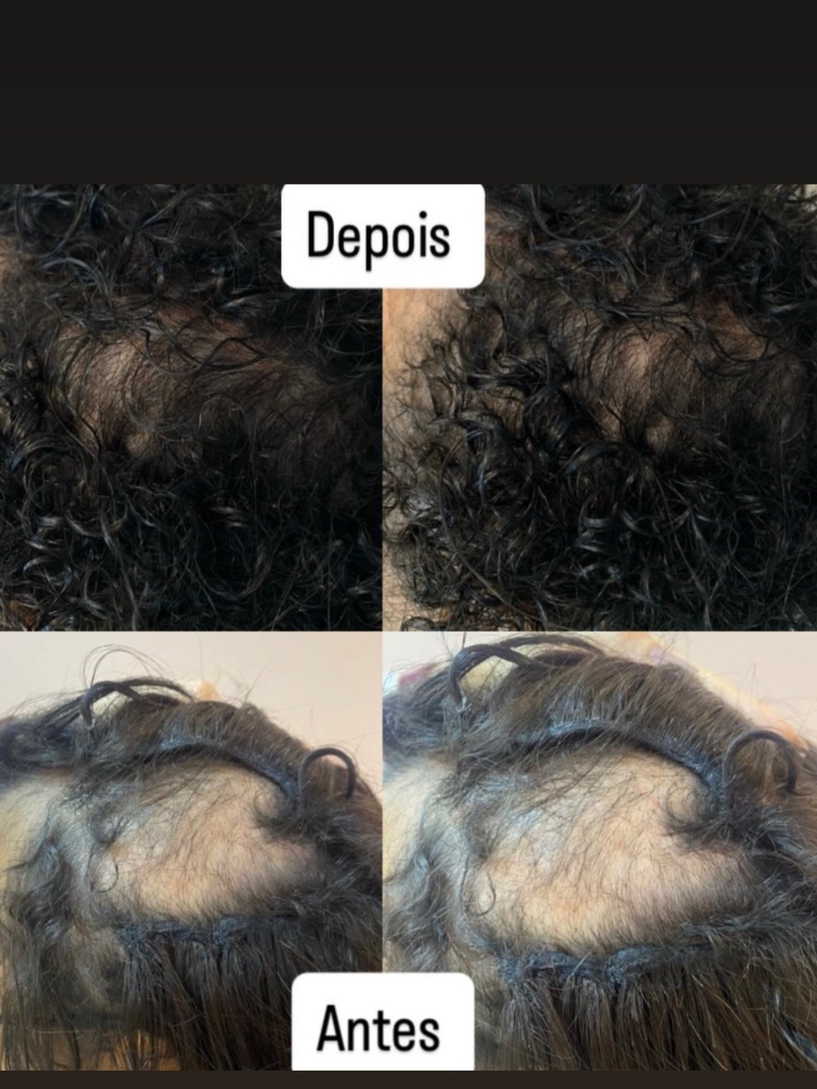 Antes e depois de tratamento capilar
